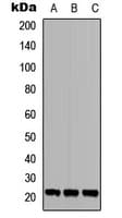 TGIF2LY Antibody (C-Terminus)