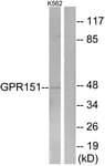 IHC-plus™ Polyclonal Rabbit anti-Human GPR151 Antibody (aa370-419, IHC, IF, WB)