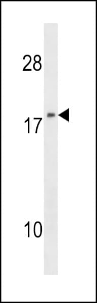 Polyclonal Rabbit anti-Human NME1 / NM23 Antibody (aa25-54, IHC, IF, WB)