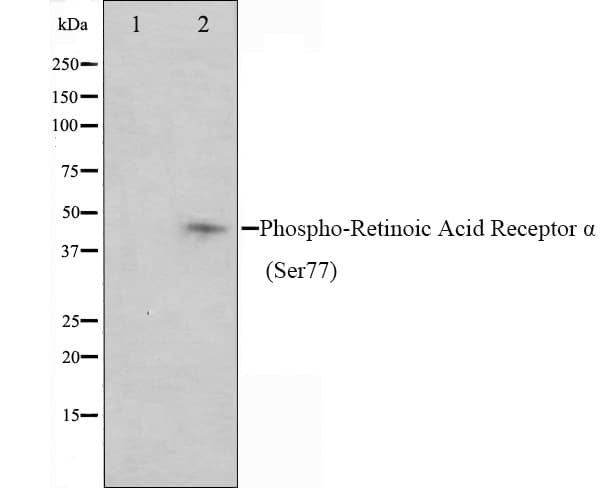 RARA / RAR Alpha Antibody (phospho-Ser77)