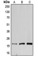 DNAL1 Antibody (Internal)