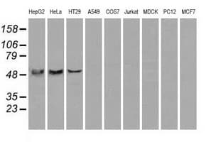 ATP5B / ATP Synthase Beta Antibody (clone OTI6C4)
