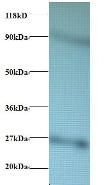 IHC-plus™ RPL17 / Ribosomal Protein L17 Antibody