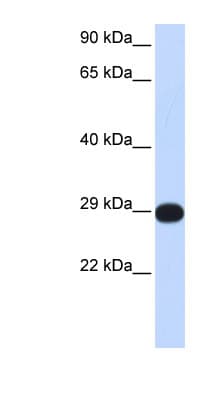 PPP4C Antibody (C-Terminus)