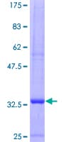 Human CCL5 / RANTES Protein (Recombinant GST)