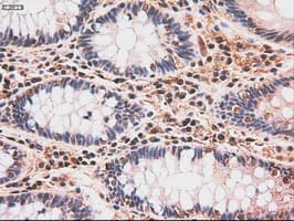 MYC / c-Myc Antibody (clone OTI3F2)