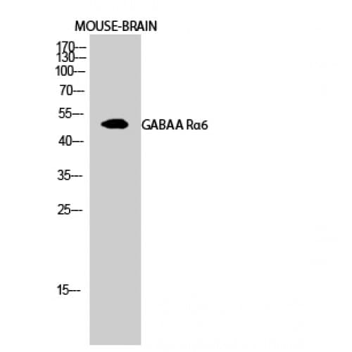 GABRA6 Antibody (30-110 aa, Internal)