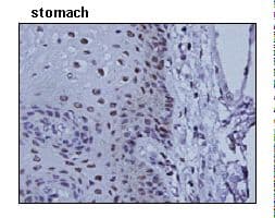Monoclonal Mouse anti-Human TOP2A / Topoisomerase II Alpha Antibody (clone 1C5, IHC, WB)