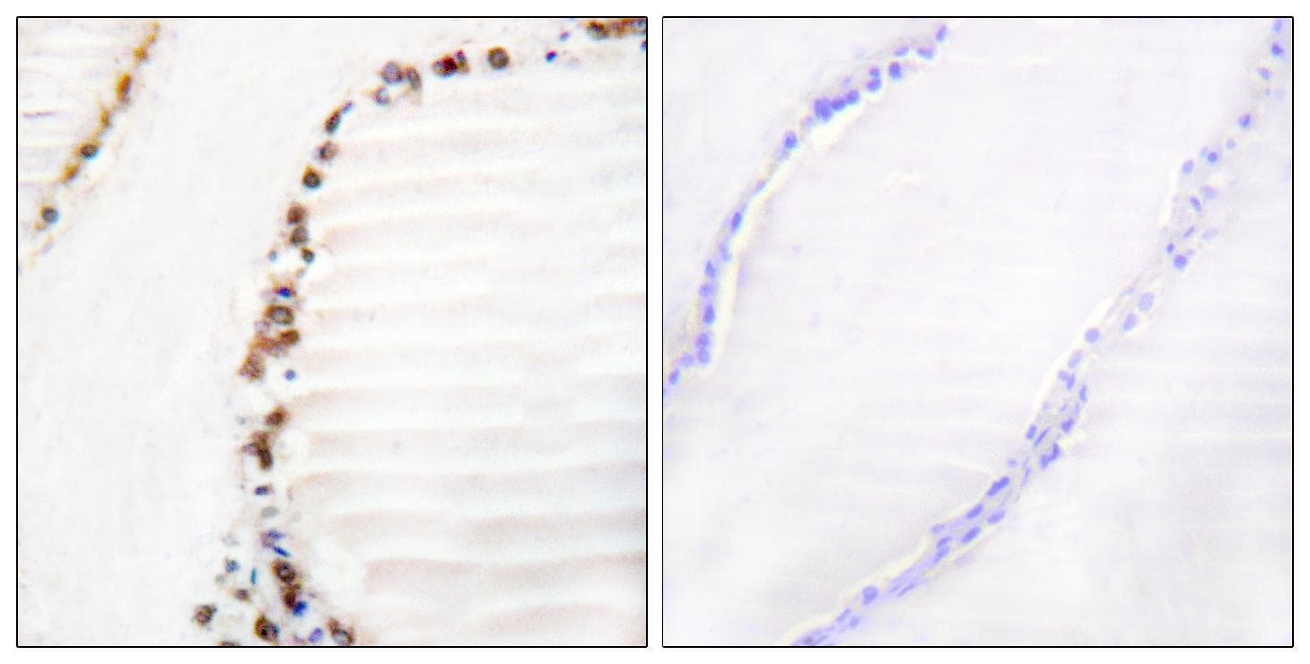 CUL3 / Cullin 3 Antibody