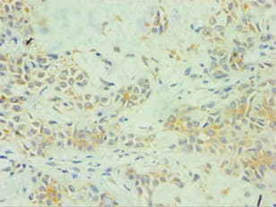 SPINT1 / HAI-1 Antibody (aa250-529)
