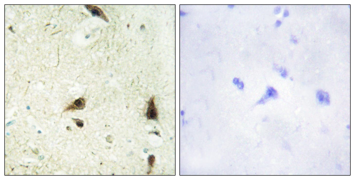 Polyclonal Rabbit anti-Human CHRAC1 Antibody (aa81-130, IHC)