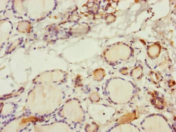 SPICE1 / CCDC52 Antibody