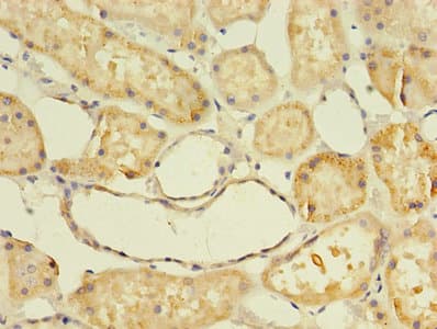Polyclonal Rabbit anti-Human APOD / Apolipoprotein D Antibody (aa21-189, IHC)