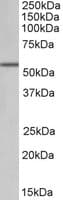 IHC-plus™ ALDH6A1 Antibody (aa487-496)