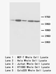 SDHA Antibody (C-Terminus, Magnetic beads)