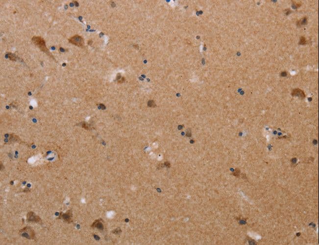 Polyclonal Rabbit anti-Human PLXNA4 / Plexin A4 Antibody (IHC)