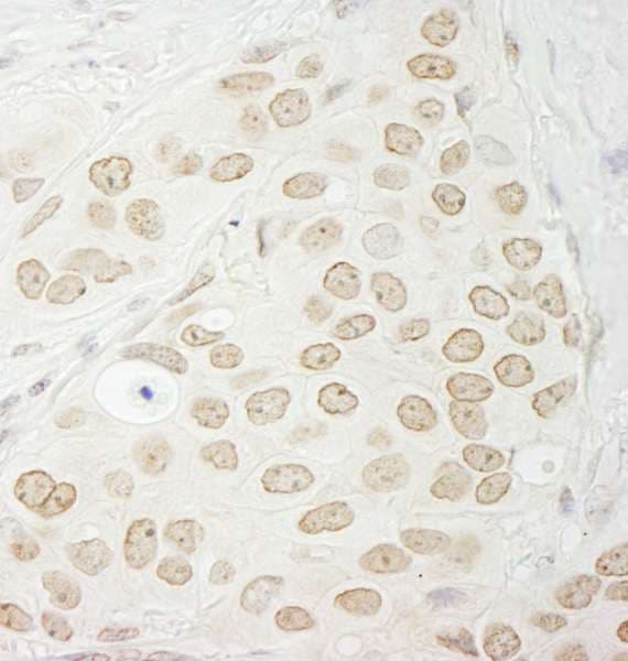Polyclonal Rabbit anti-Human PPP1CC / PP1 Gamma Antibody (aa280-C-term, IHC, WB)