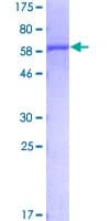 Human UROD Protein (Recombinant GST)