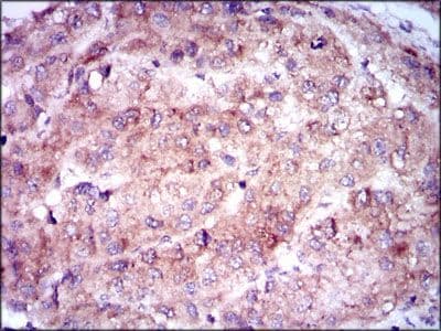 ENO2 / NSE Antibody (Amino Acid: 251-433, clone 5D3)