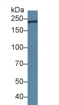 TCHH / Trichohyalin Antibody (aa1851-1943)