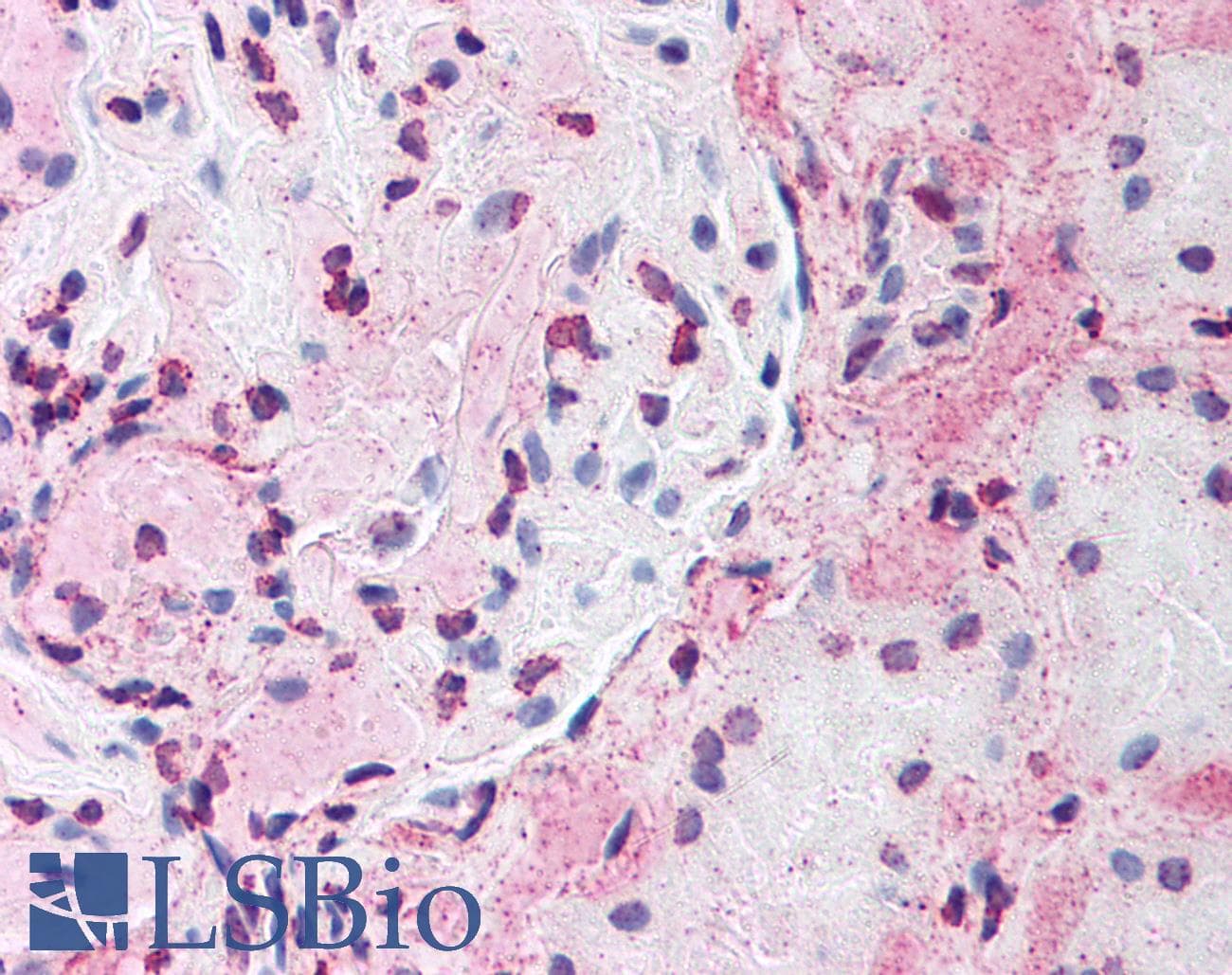 IHC-plus™ HIF1A / HIF1 Alpha Antibody (aa432-528, clone H1alpha67)