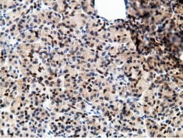 EPM2AIP1 Antibody (clone OTI2G3)