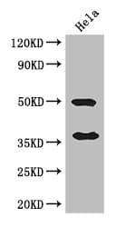 AKR1B1 / Aldose Reductase Antibody