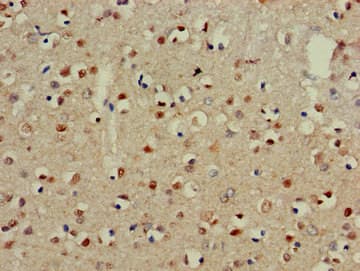 NECL-1 / CADM3 Antibody