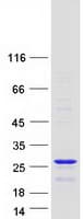 Human THOC7 Protein (Recombinant Myc-DDK (Flag))