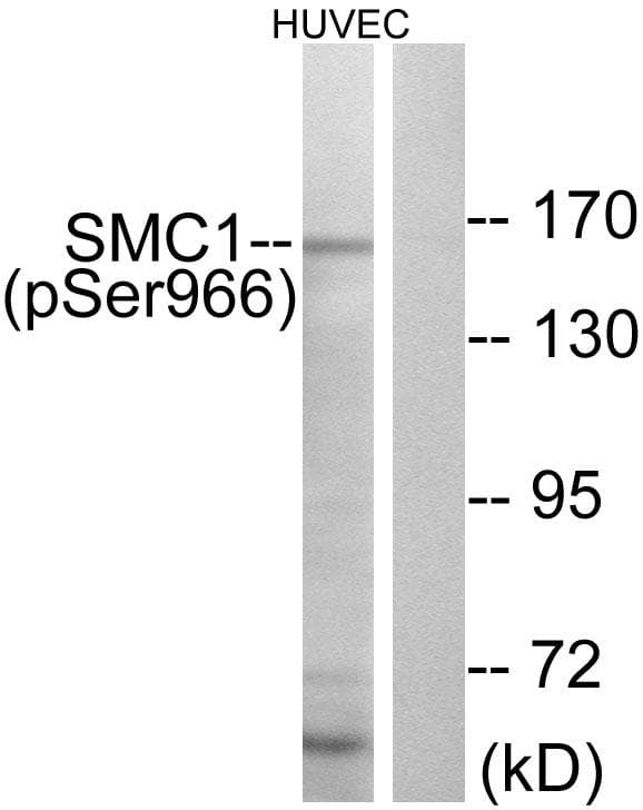 SMC1A / SMC1 Antibody (phospho-Ser966)