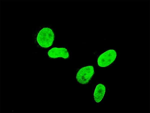 TBX3 Antibody (clone 7H6)