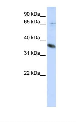 ST6GALNAC1 Antibody (aa396-445)