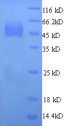 Rat SDC1 / Syndecan 1 / CD138 Protein (Recombinant His)