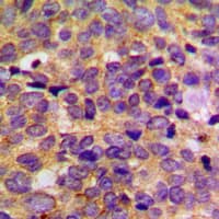 Polyclonal Rabbit anti-Human PRKAR2B Antibody (Internal, IHC, WB)