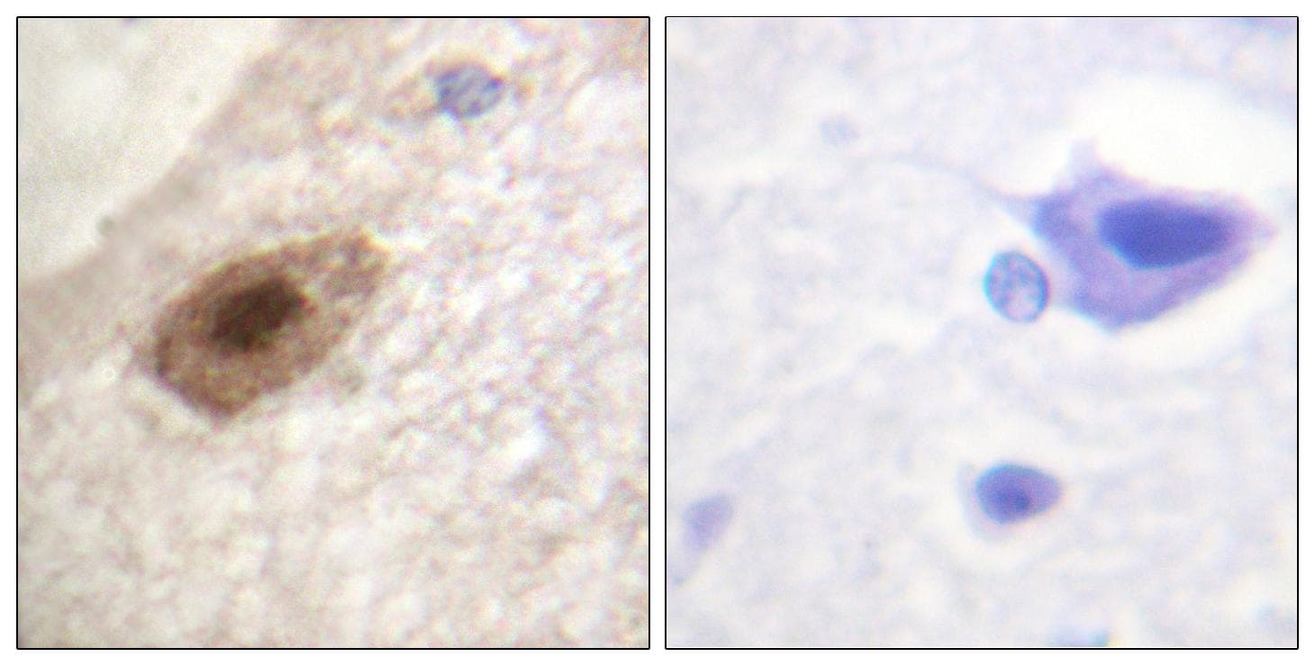 DDX3 / DDX3X Antibody (phospho-Thr322)