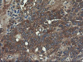 Monoclonal Mouse anti-Human VBP1 Antibody (clone OTI2C2, IHC, WB)