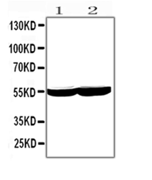 CYP2E1 Antibody (aa1-310)