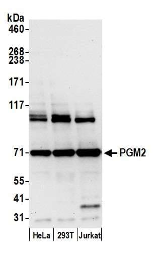 Polyclonal Rabbit anti-Human PGM2 Antibody (aa175-225, WB)