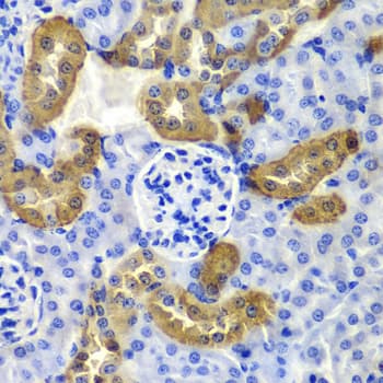 IHC-plus™ KRT19 / CK19 / Cytokeratin 19 Antibody