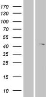 ABHD12 Protein (Over-Expression Lysate Myc-DDK (Flag))
