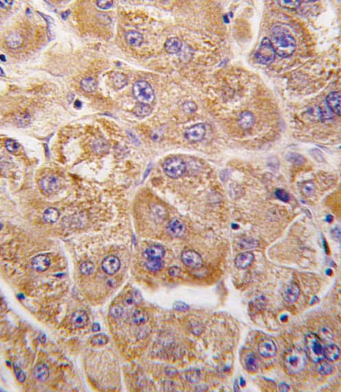 IDE Antibody (aa406-435)