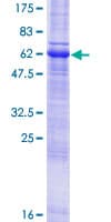 Human WBP1 Protein (Recombinant GST)