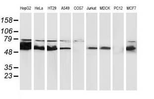 CAT / Catalase Antibody (clone OTI3C3)
