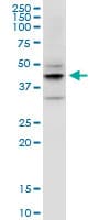 Monoclonal Mouse anti-Human DSPG3 / Epiphycan Antibody (clone 2G6, WB)