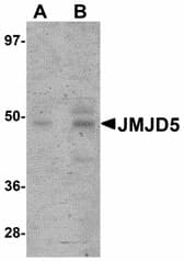 IHC-plus™ Polyclonal Rabbit anti-Human KDM8 / JMJD5 / FLJ13798 Antibody (IHC, IF, WB)