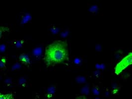 APP / Beta Amyloid Precursor Antibody (clone OTI7G9)