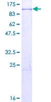 Human SMURF1 Protein (Recombinant GST)