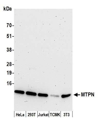 Polyclonal Rabbit anti-Human MTPN / Myotrophin Antibody (aa68-118, WB)