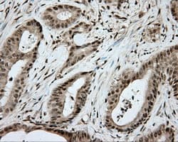 APP / Beta Amyloid Precursor Antibody (clone OTI5F1)