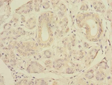 SLC4A8 / NBC Antibody